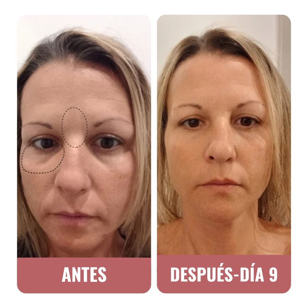 Me dicen que tengo buena cara, que he rejuvenecido.