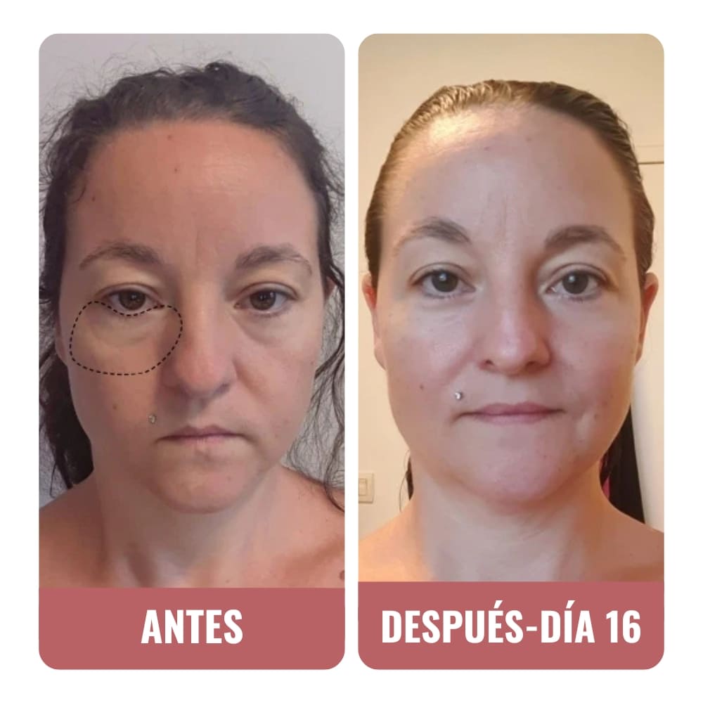 Estoy encantada, es mi tratamiento favorito.