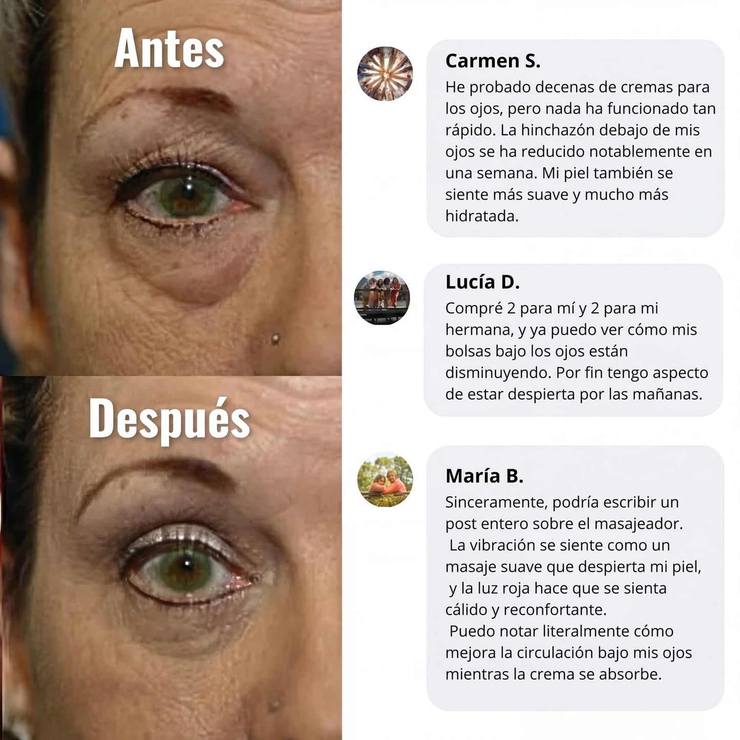 Crema de luz roja para el contorno de ojos