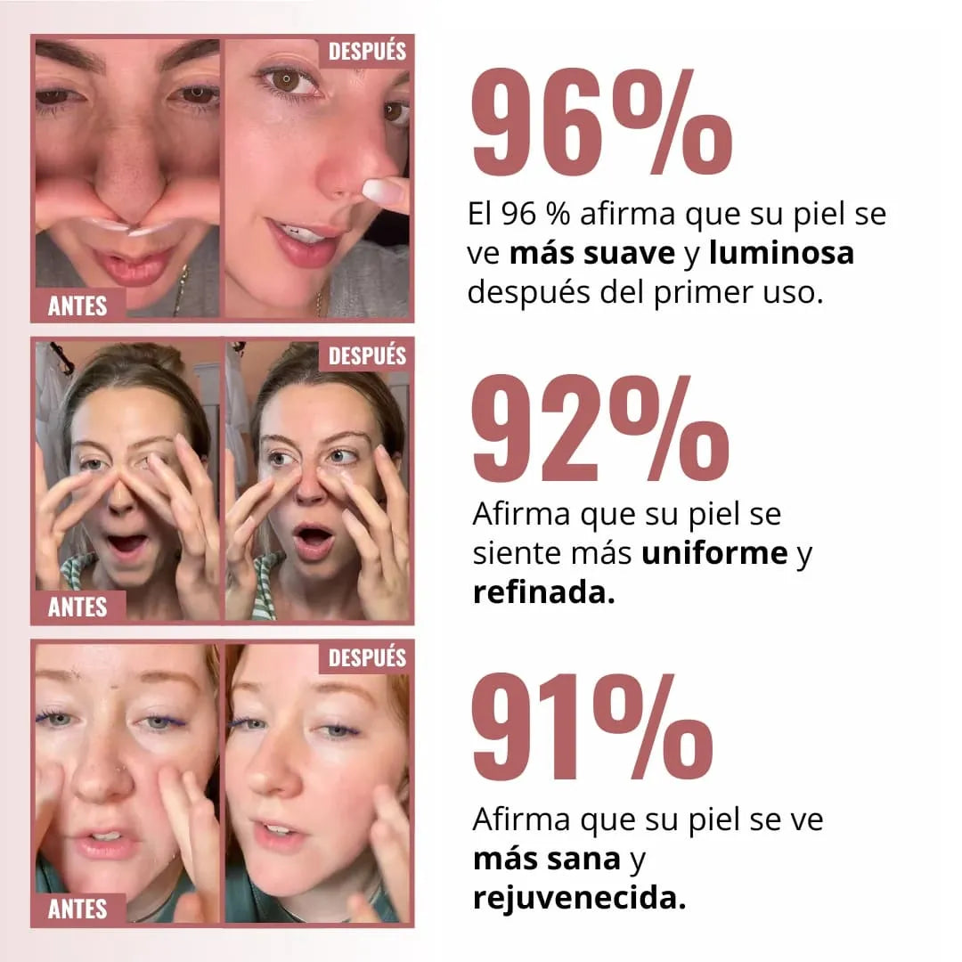 Peel Shot Coreano-Elimina las impurezas y realza tu piel