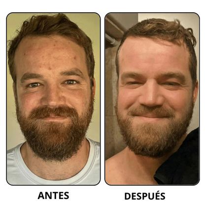 Peel Shot Coreano-Elimina las impurezas y realza tu piel