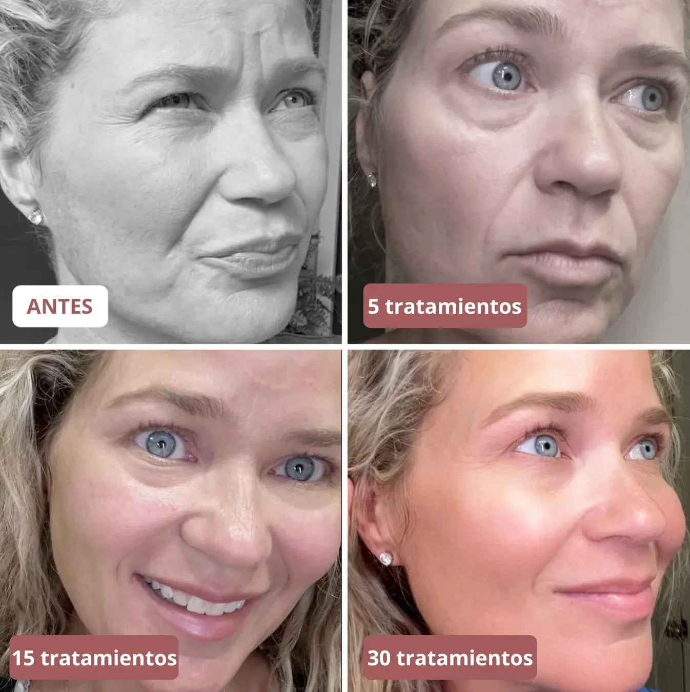 5 mascarillas de colágeno