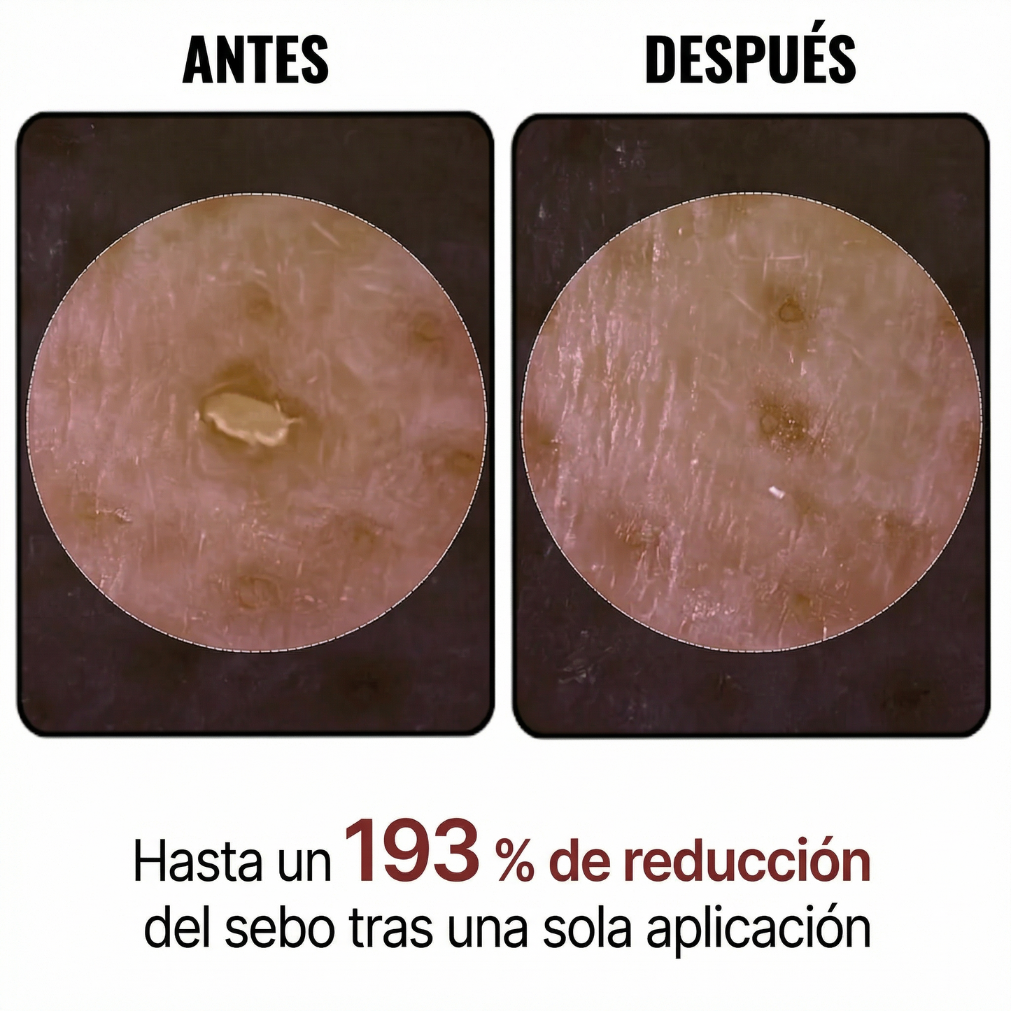 Peel Shot Coreano-Elimina las impurezas y realza tu piel