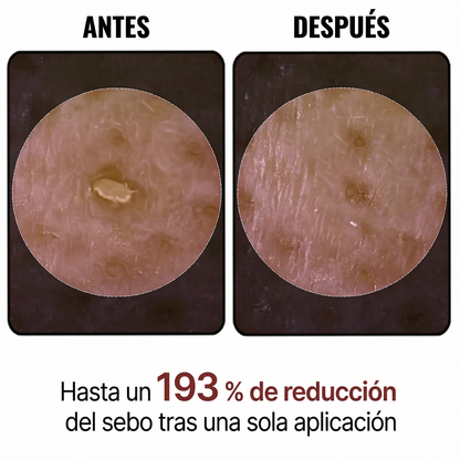 Peel Shot Coreano-Elimina las impurezas y realza tu piel