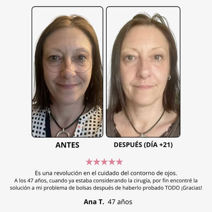 Crema de luz roja para el contorno de ojos