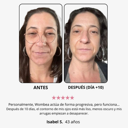 Crema de luz roja para el contorno de ojos